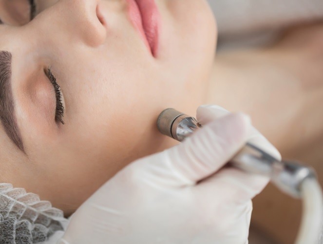 How To Choose The Best At-Home Microdermabrasion Machine
