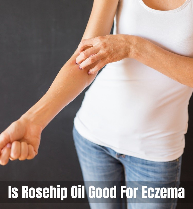 Is Rosehip Oil Good For Eczema