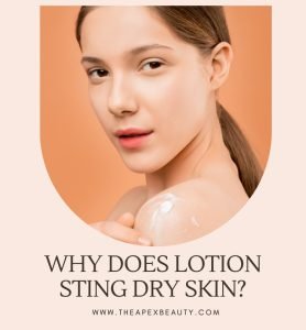 Why Does Lotion Sting Dry Skin? Expert Insights on Sensitivity And