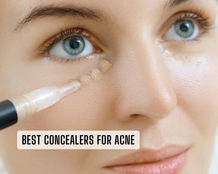 best concealers for acne