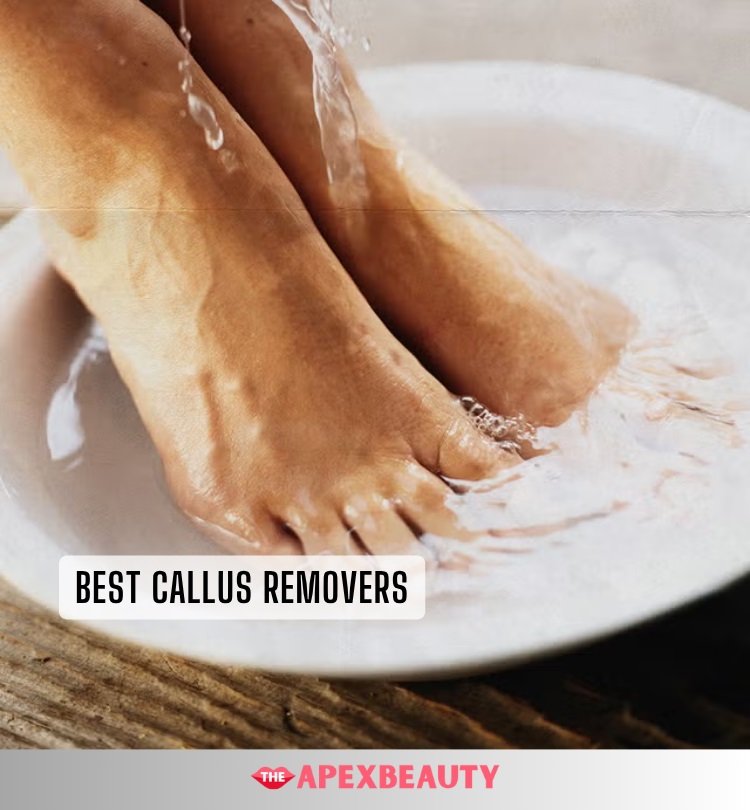 best callus removers